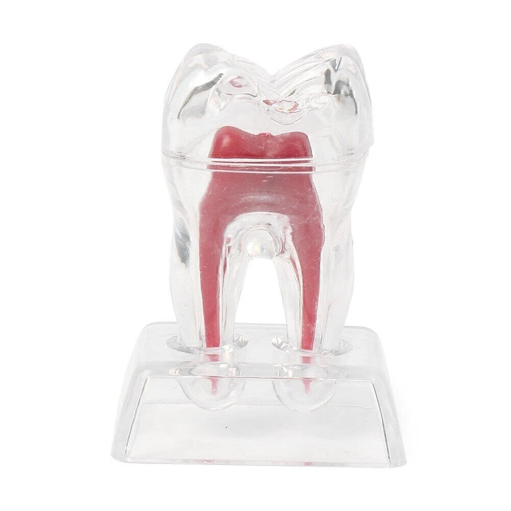 Dental Crystal Base Hard Plastic Tooth Molar Model Teaching Tool Kit