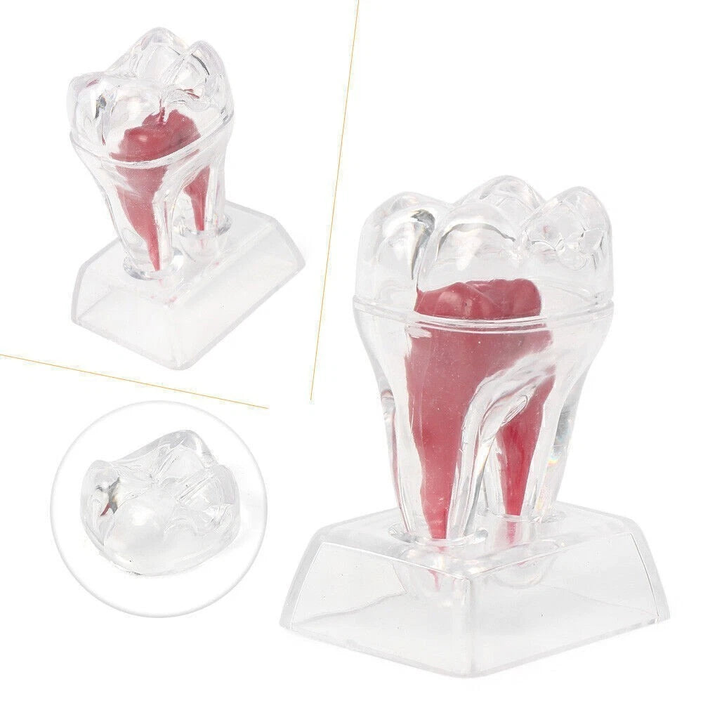 Dental Crystal Base Hard Plastic Tooth Molar Model Teaching Tool Kit