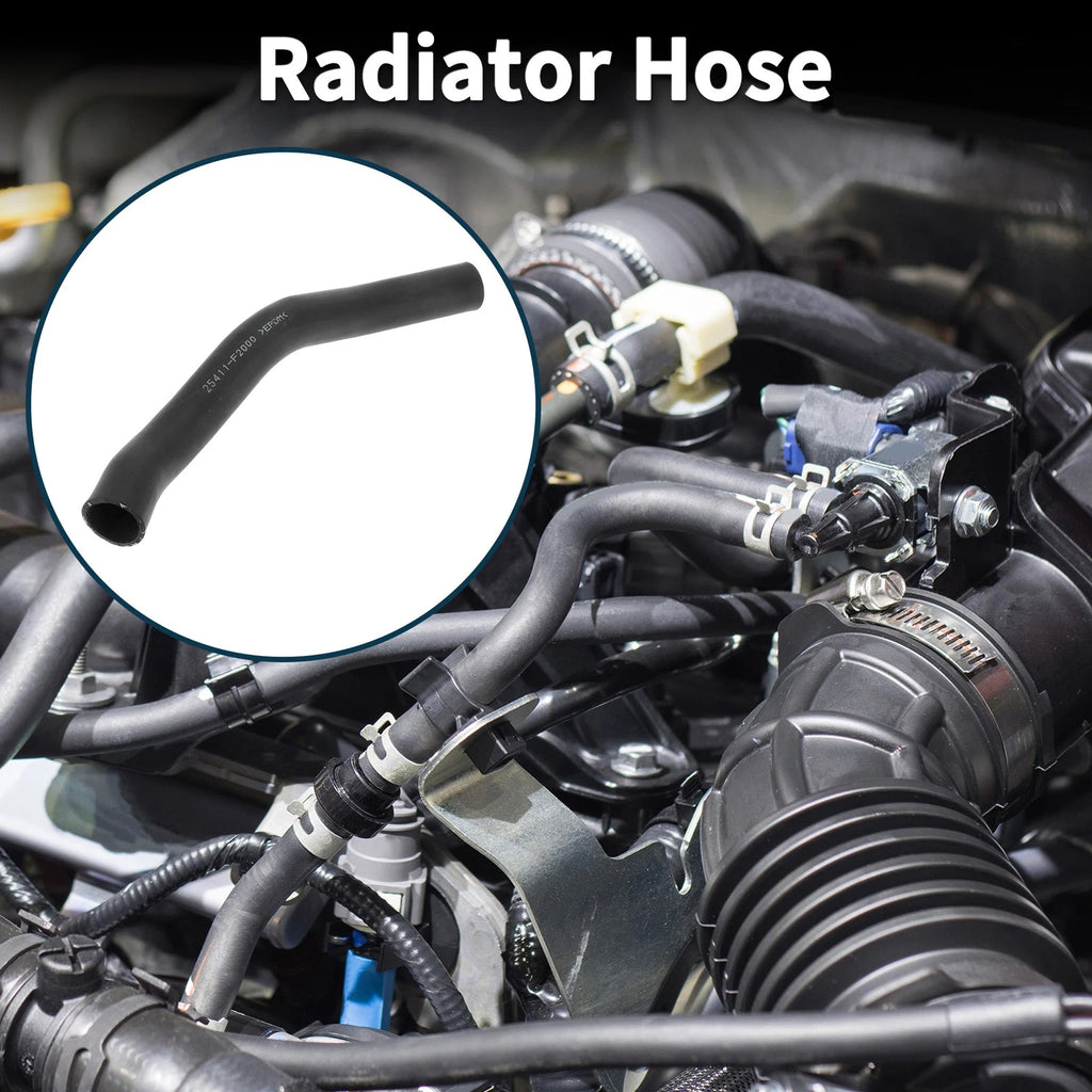 Radiator Hose Replacement for Hyundai Elantra (2015–2020) UPIPE