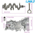 Engine Rebuild Kit for Hyundai Kia 2.0L (Crankshaft, Con Rods, Timing Kit)
