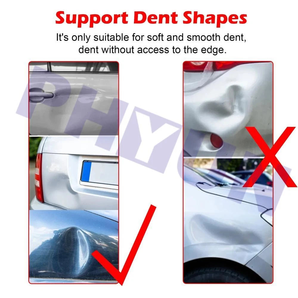 Car Dent Repair Tools Cold Glue Tab Kit for Universal Use (2010–2023)