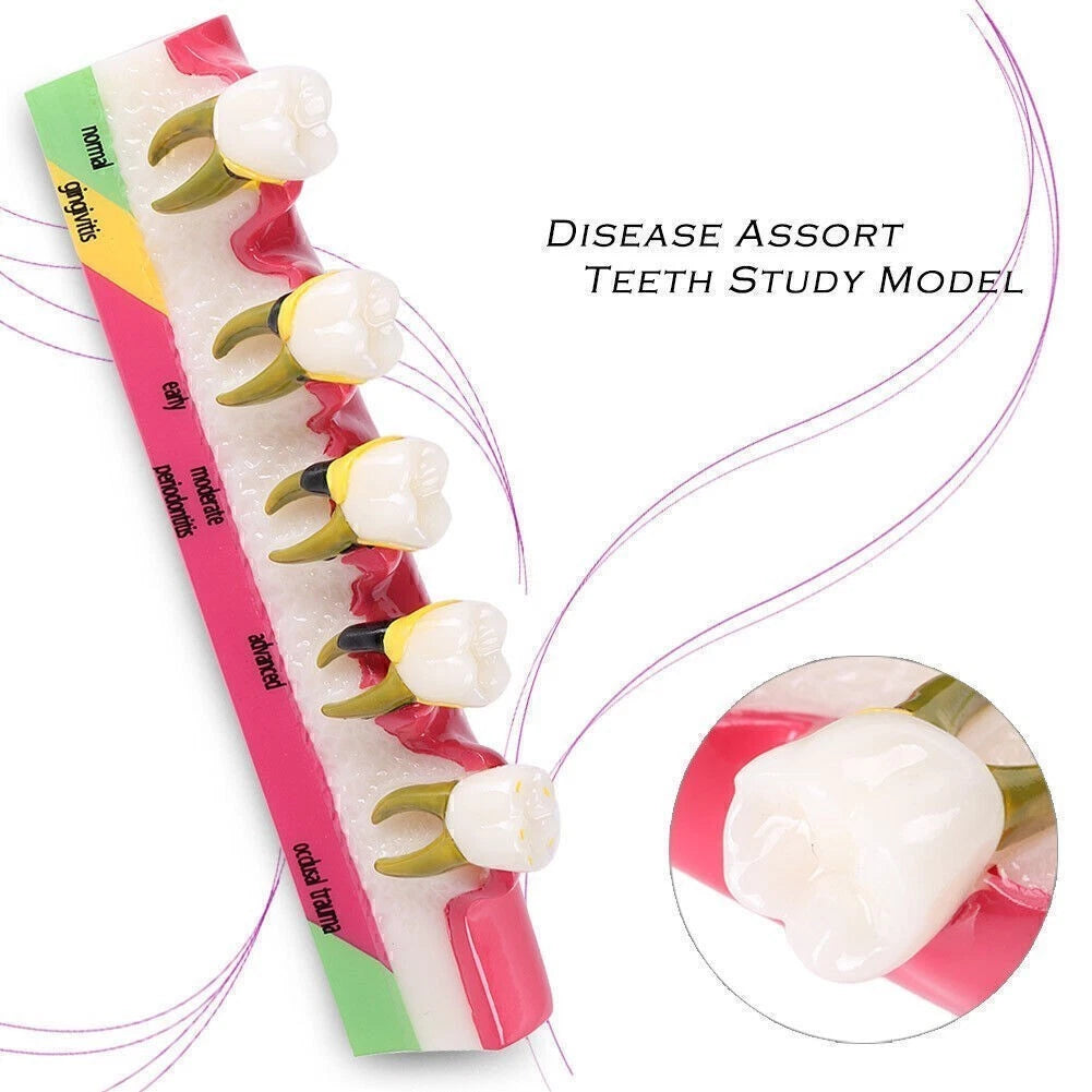 Dental Typodont Teeth Model for Study and Teaching