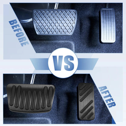 Brake Pedal Pad Cover Set for Hyundai Elantra (2021–2022) Black Alloy