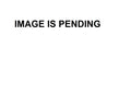 WSM Water Pump Kit for Yamaha 200-300 HP HPDI (2000–2006) - 750-436
