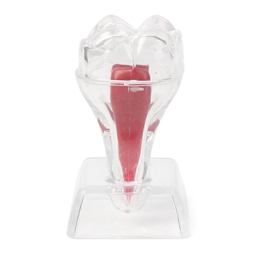 Dental Crystal Base Hard Plastic Tooth Molar Model Teaching Tool Kit