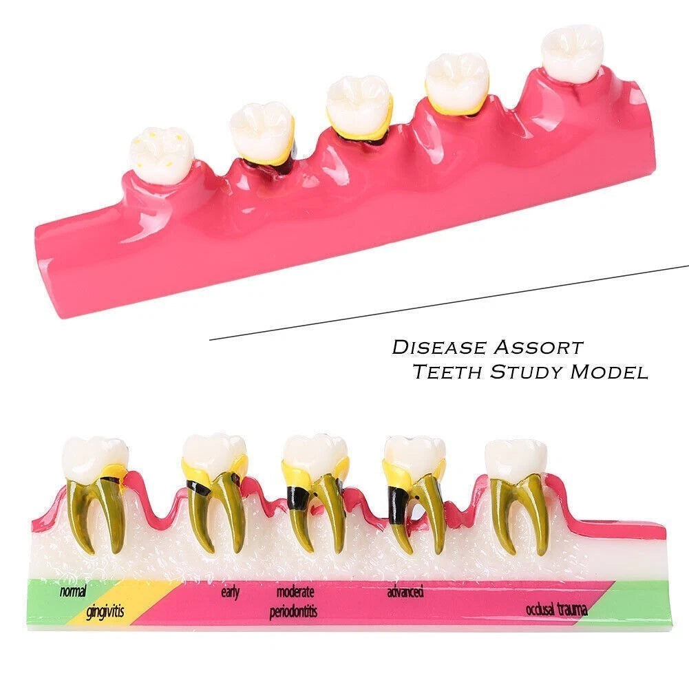 Dental Typodont Teeth Model for Study and Teaching
