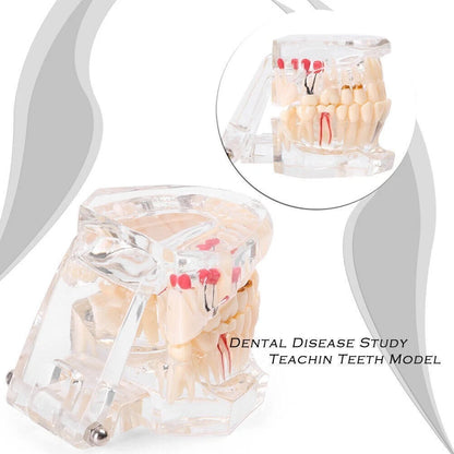 Dental Study Teeth Model for Adult Pathological Disease