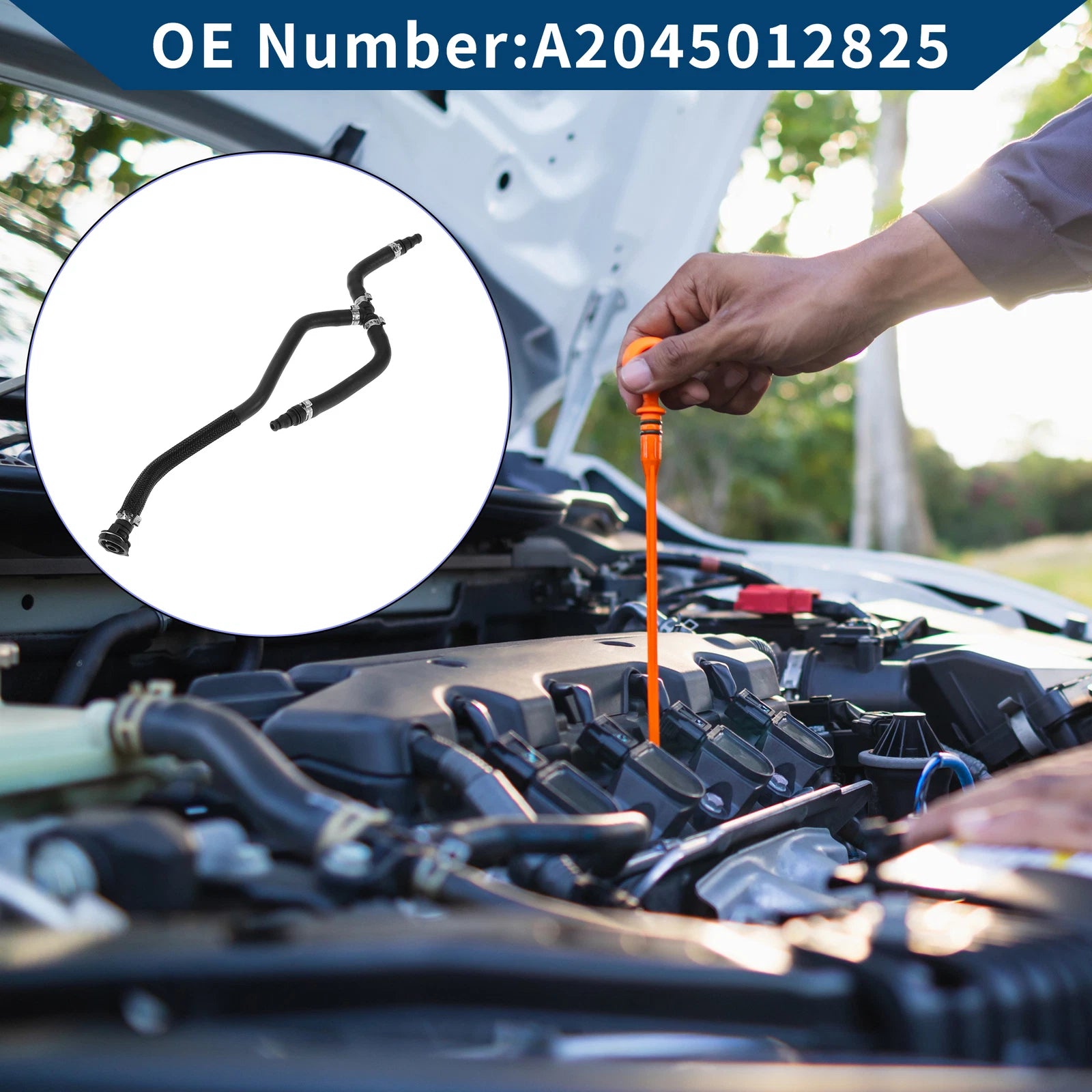 Radiator Hose Replacement for Mercedes-Benz C-Class C180 C204 (2013–2024)