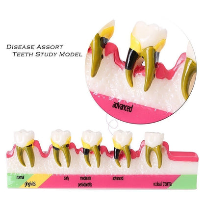 Dental Typodont Teeth Model for Study and Teaching