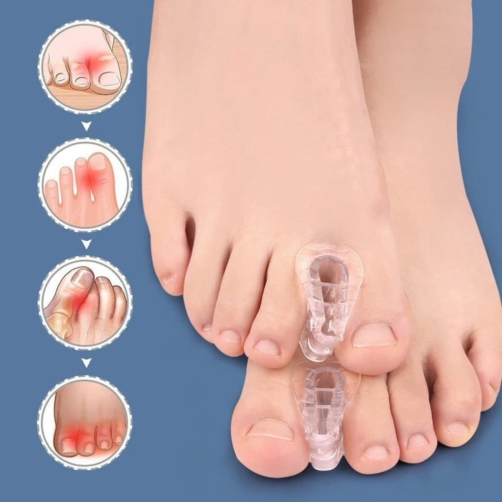 Toe Separator for Bunion Relief (Transparent)